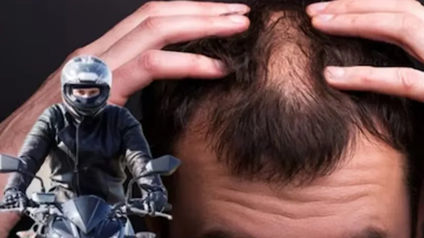 Hair Care Tips: హెల్మెట్ ధరించడం వల్ల జుట్టు రాలుతుందా? ఇలా చేస్తే ఒక్క వెంట్రుక కూడా ఊడిపోదు!