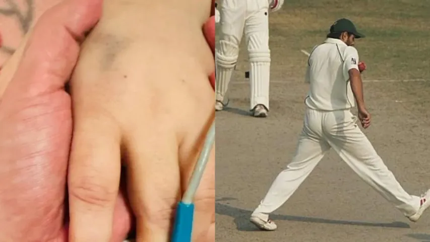 Cricket News: లెజెండరీ క్రికెటర్‌ సోదరి మృతి.. విషాదంలో అభిమానులు..!