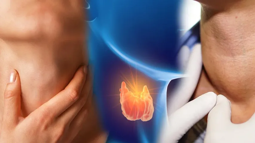 Thyroid
