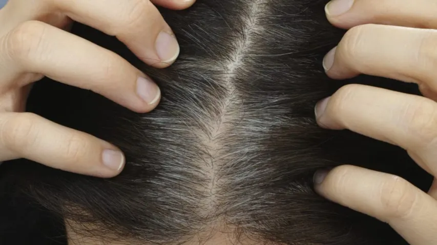 Hair Health: మీకు ఈ అలవాట్లు ఉంటే చిన్నతనంలోనే తెల్ల జుట్టు వచ్చేస్తుంది!
