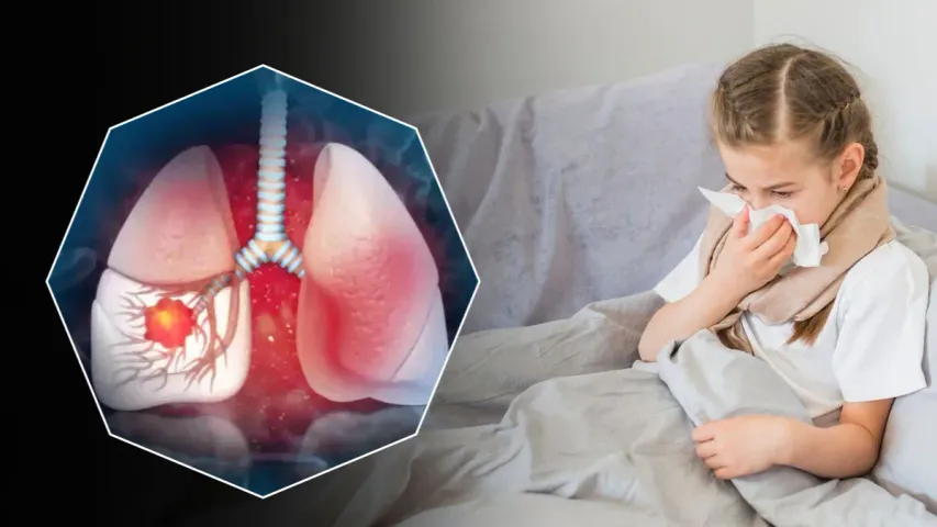 White Lung Syndrome: చైనాలో కరోనాను మించిన వైరస్‌..గడగడలాడుతున్న ప్రపంచ దేశాలు