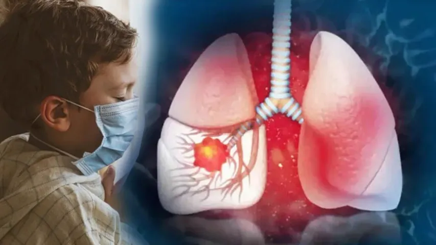 White Lung Syndrome: అమెరికాలో వైట్ లాంగ్ సిండ్రోమ్ కలకలం.. చైనా పర్యటనల నిషేధానికి డిమాండ్ 