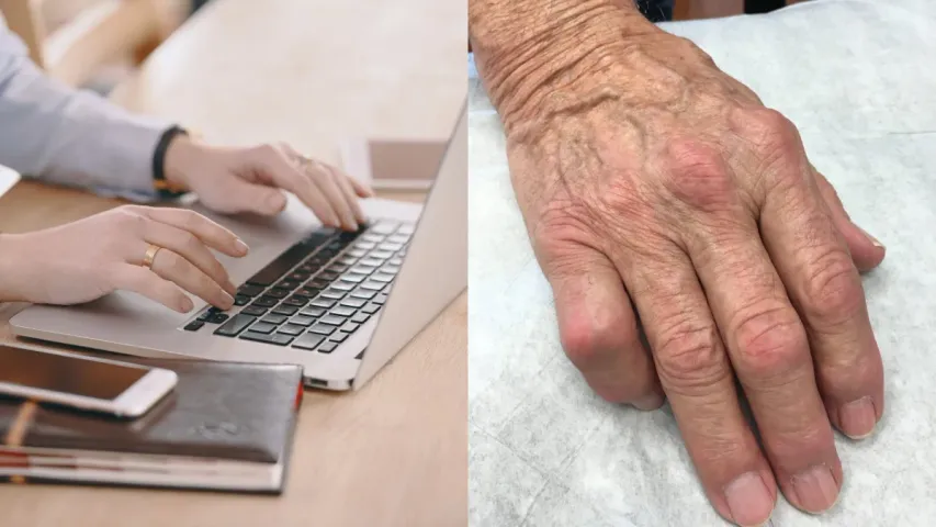 Trigger Finger Disease:ల్యాప్‌టాప్‌లో ఎక్కువ సేపు పనిచేస్తే ట్రిగ్గర్‌ ఫింగర్‌ వ్యాధి వస్తుందా?