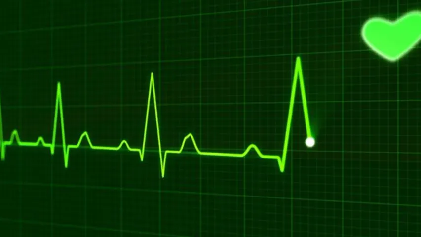 Health Tips: ECGలో 100 కంటే ఎక్కువ BPM ప్రమాదకరమా?