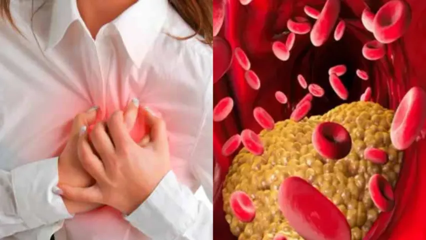Heart Attacks : ట్రైగ్లిజరైడ్స్ అంటే ఏమిటి..? నిర్లక్ష్యం చేస్తే గుండెపోటు ఖాయమా..?