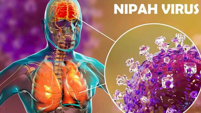 Nipah Virus: నిపా వైరస్‌కు వ్యాక్సిన్ వచ్చేస్తోంది.. చివరి దశలో ఆక్స్‌ఫర్డ్ పరిశోధనలు