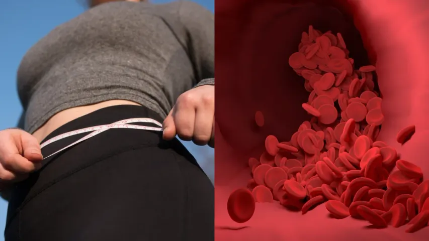 Obesity : ఊబకాయం ఉన్నవారికి బ్లడ్ క్యాన్సర్ వస్తుందా?