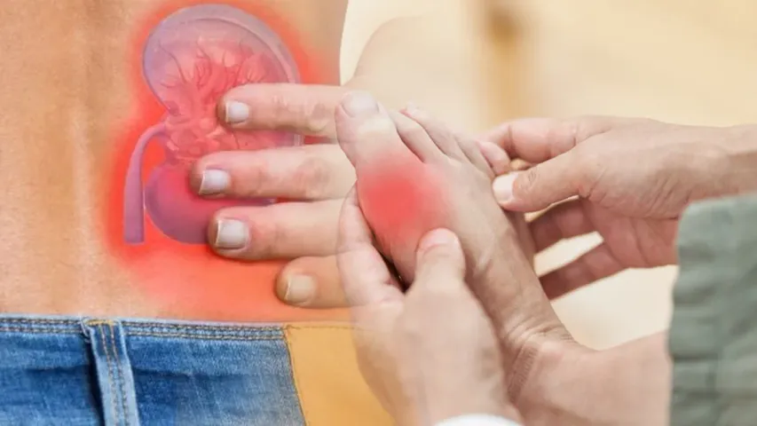 Uric Acid: యూరిక్ యాసిడ్ ఎవరికి ఎక్కువ ప్రమాదాన్ని తెస్తుంది  