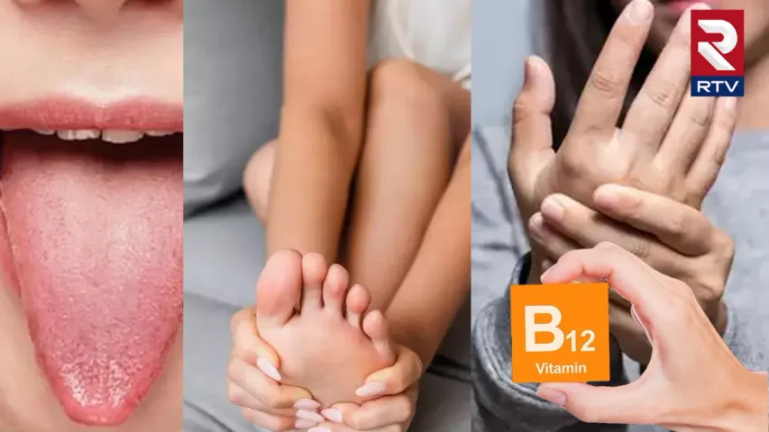 Vitamin B12 Deficiency: విటమిన్ బి-12 లోపం.. పైకి తెలీకుండానే కొంప ముంచేస్తుంది.. 