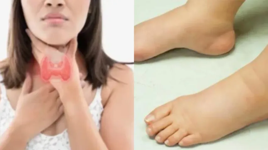 Feet Swelling: పాదాల్లో వాపు ఎందుకు వస్తుంది..సకాలంలో గుర్తించకపోతే అంతేనా?