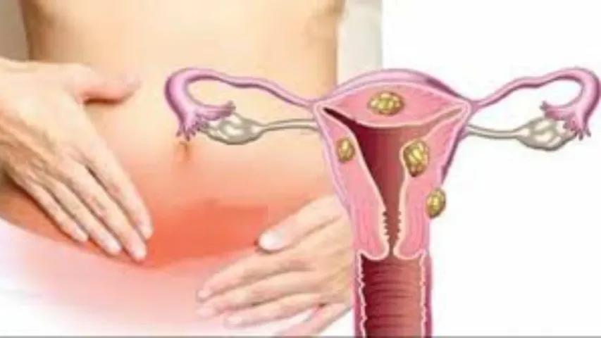 Health Tips: గర్భసంచి తొలగింపు తర్వాత ఏ జాగ్రత్తలు తీసుకోవాలి..?