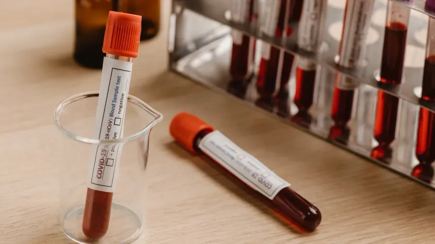 Blood Group: మీరు ఎలాంటి వారో మీ బ్లడ్ గ్రూప్ చెబుతుందట..తాజా పరిశోధనలో వెల్లడి..!!
