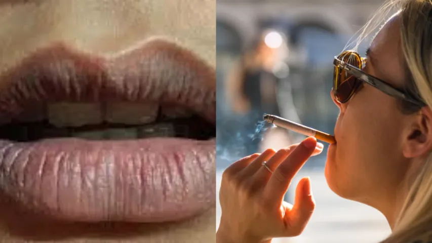 Black Lips: సిగరెట్ వల్ల మీ పెదాలు నల్లగా మారాయా?..ఈ సమస్యలు తప్పవు