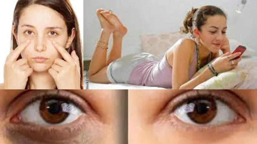 Dark Circles Under The Eyes: కళ్ళ కింద నల్లని వలయాలున్నాయా? ఇలా చేస్తే మంచి రిజల్ట్ వస్తుంది