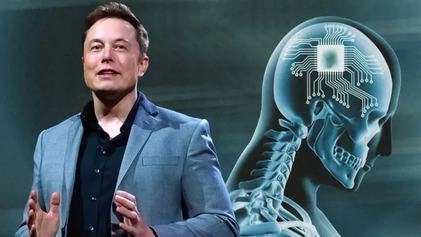 Neuralink Brain Chip: బ్రెయిన్ చిప్ ఇంప్లాంట్ మొదటి దశ సక్సెస్.. అంధులలో ఆశలు రేపుతున్న మస్క్!