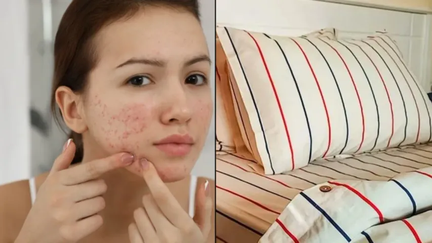 Face Tips : నిద్రకు ముందు ఇలా చేస్తే మొటిమలు పెరుగుతాయి