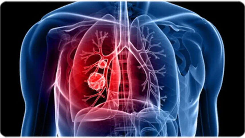 Health Tips: పురుషుల్లో ఈ లక్షణాలు కనిపిస్తే ఏదైనా క్యాన్సర్ కావచ్చు..జర భద్రం!