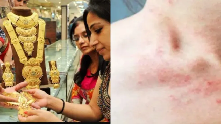 Roldgold Jewellery: రోల్డ్‌గోల్డ్‌ నగలు వేసుకుంటున్నారా..అయితే ఈ వ్యాధులు ఖాయం