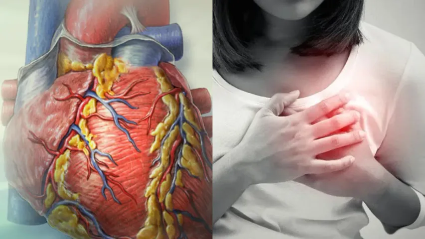 Heart Attack: ఇలా చేస్తే గుండెపోటు నుంచి మిమ్మల్ని మీరే కాపాడుకోవచ్చు