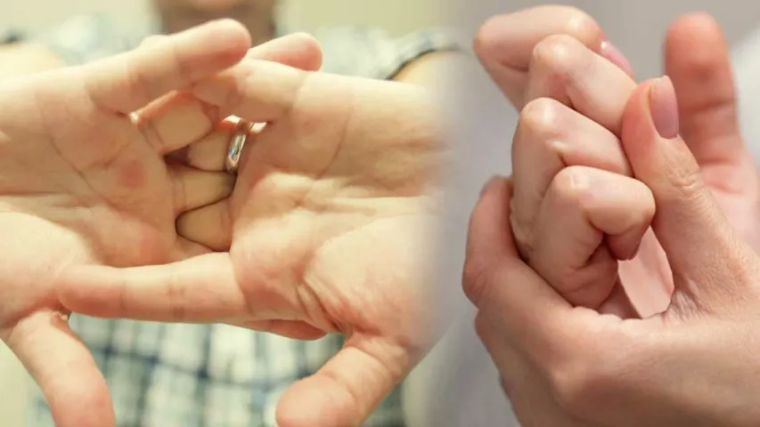 Fingers Tips: వేళ్లు విరిచే అలవాటు చెడ్డదా..మంచిదా?