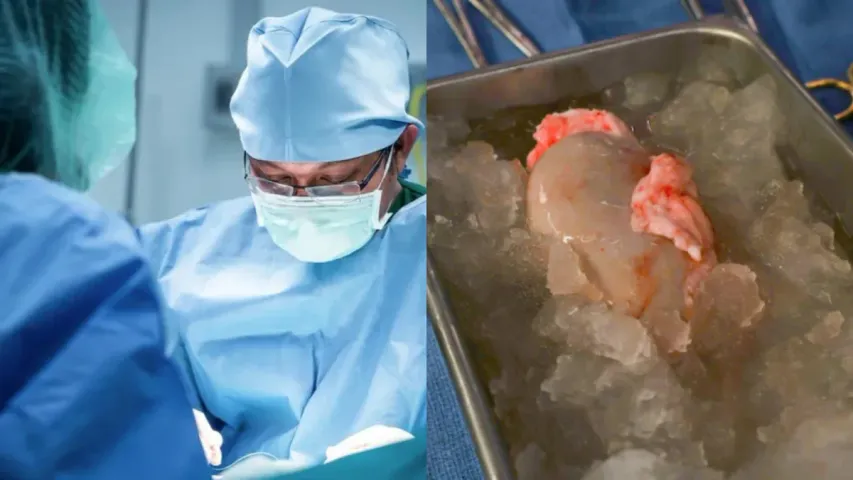 Pig Kidney To Human: చరిత్రలో తొలిసారి.. బతికి ఉన్న మనిషికి పంది కిడ్నీని అమర్చిన డాక్టర్లు!