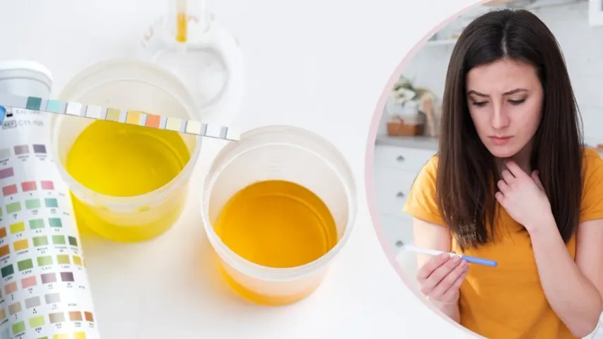 Health Tips: వేసవిలో మూత్రం పసుపు రంగులో వస్తుందా?.. ఈ వ్యాధికి కారణం కావొచ్చు