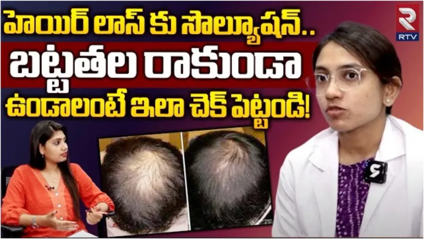 Baldhead: బట్టతల రాకుండా ఉండాలంటే.. ఇలా చేయండి..!
