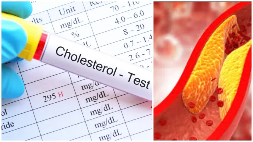 Cholesterol Test : కొలెస్ట్రాల్ టెస్ట్ కు వెళ్లేముందు ఈ పొరపాట్లు అస్సలు చేయకండి.. జాగ్రత్త..!