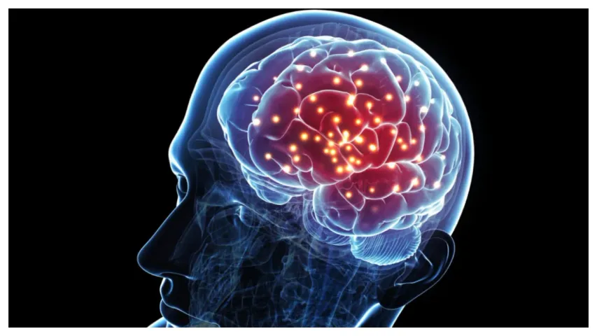 Brain Stroke: బ్రెయిన్ స్ట్రోక్‌తో జాగ్రత్త!
