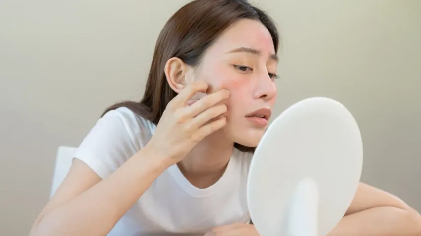 Skin Care : మొహానికి టూత్ పేస్ట్ అప్లై చేస్తున్నారా..? మీ అందం పాడైనట్లే..జాగ్రత్త..!