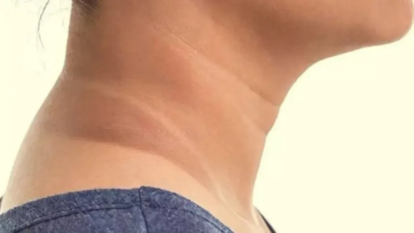 Skin Care: నెల రోజుల్లో శరీరంపై నలుపు పొగొట్టి తెల్లగా మార్చే చిట్కాలు