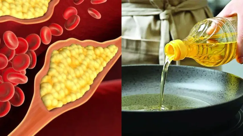 Cholesterol: కొలెస్ట్రాల్ తగ్గించుకోవాలనుకుంటున్నారా?..ఈ నూనెలు వాడండి
