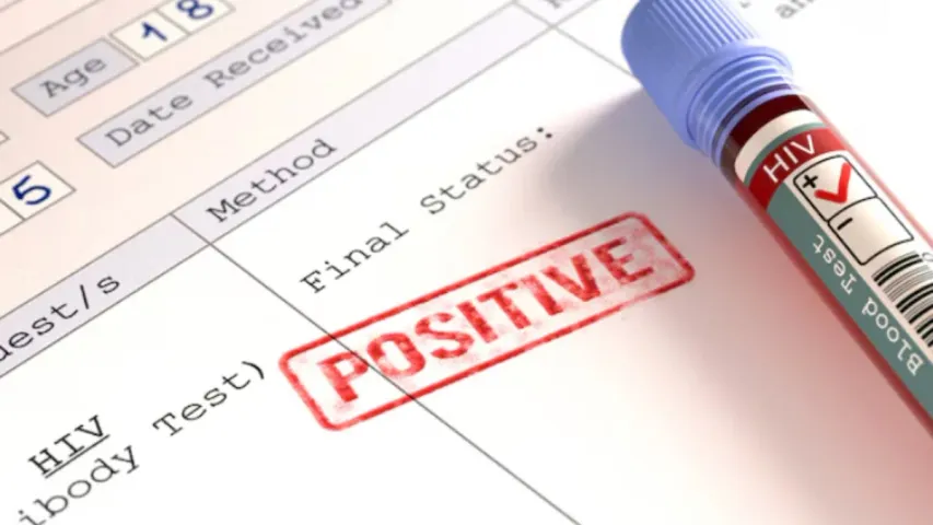HIV: వాంపైర్‌ ఫేషియల్‌ చేయించుకున్న మహిళలకు హెచ్‌ఐవీ!