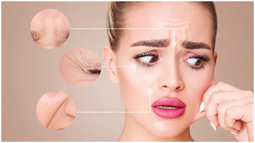 Skin Care: మొహం పై ముడతలకు ఈ అలవాట్లే కారణం..! త్వరగా మానుకోండి