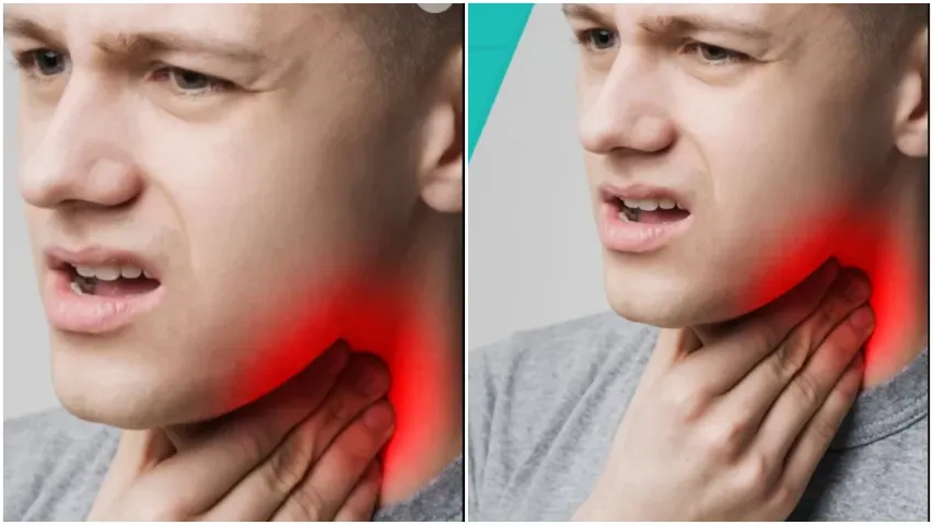 Tonsils :  టాన్సిల్స్ నొప్పి విపరీతంగా ఉందా..? ఈ ఇంటి చిట్కాలతో తక్షణ ఉపశమనం