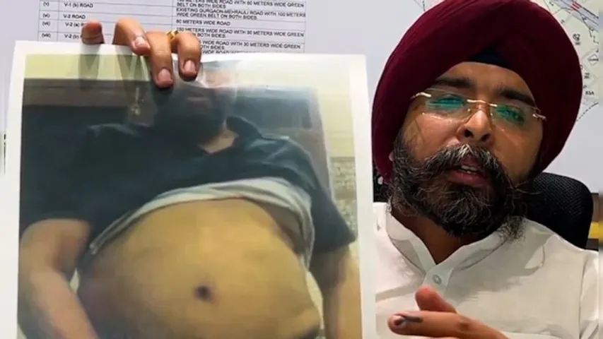Watch Video : ఆప్‌ నేత బండారం బయటపెట్టిన బీజేవైఎం నాయకుడు