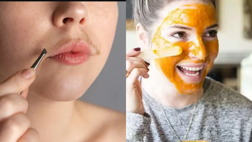 Facial Hair : ఫేషియల్, అప్పర్ లిప్ హెయిర్ తొలగించే ఫేస్ ప్యాక్.. ట్రై చేయండి