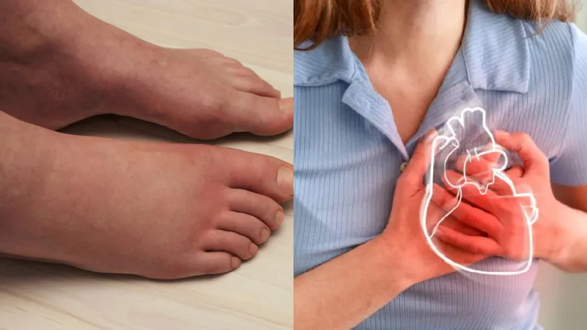 Swollen Feet: మీ పాదాలు ఉబ్బి ఉంటే ఇలా చేయండి... లేకపోతే ఆ వ్యాధుల ప్రమాదం తప్పదు!