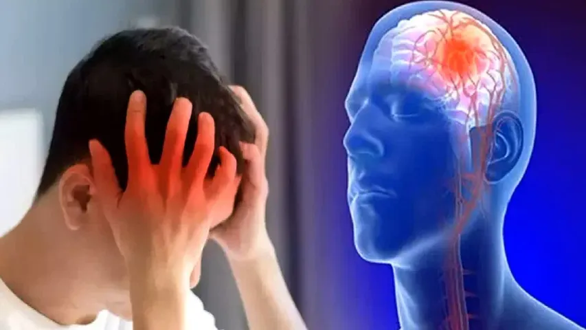 Brain Stroke : బ్రెయిన్ స్ట్రోక్ లక్షణాలివే!