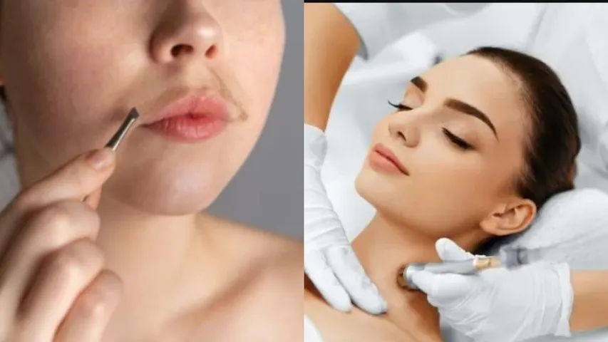 Face Tips: మీ ముఖంపై అవాంఛిత రోమాలు పెరుగుతున్నాయా? ఇలా వదిలించుకోండి!