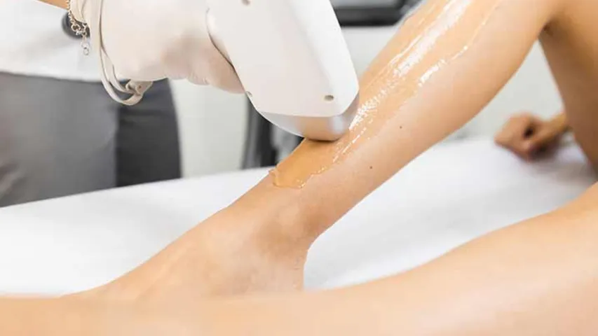 Beauty Tips: లేజర్‌తో ఇలా హెయిర్ రిమూవల్ చేయవచ్చు.. లేకపోతే అది మీ చర్మానికి హాని కలిగిస్తుంది!