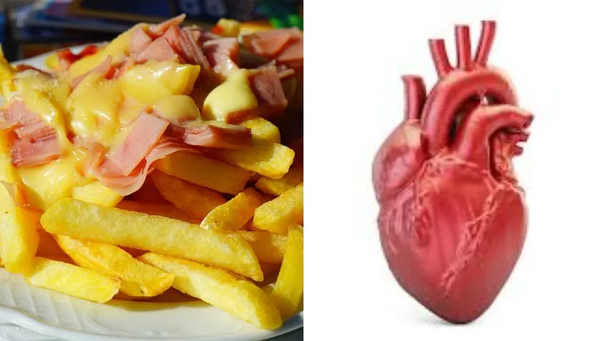 Cholesterol: ఈ ఆహారాలు తింటే మీరు హార్ట్ పేషెంట్ అవుతారు.. అందుకే తినవద్దు