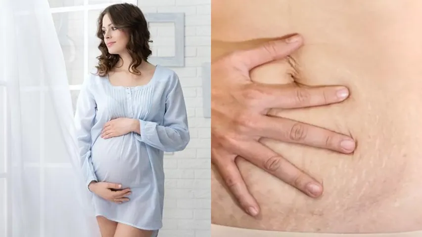 Postpartum Care: డెలివరీ తర్వాత చర్మం నిస్తేజంగా మారిందా? ఏం చేయాలో తెలుసుకోండి!