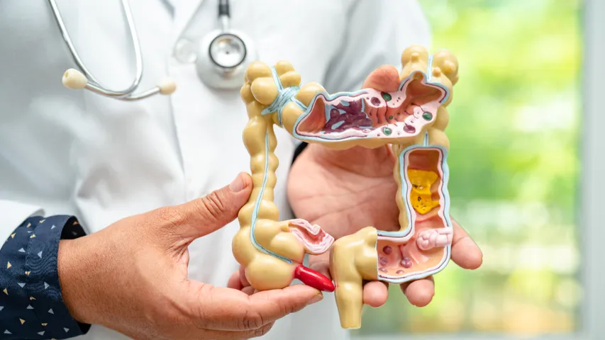 Cancer: ప్రేగు క్యాన్సర్ ఎలా వస్తుంది? వాటి లక్షణాలేంటి?