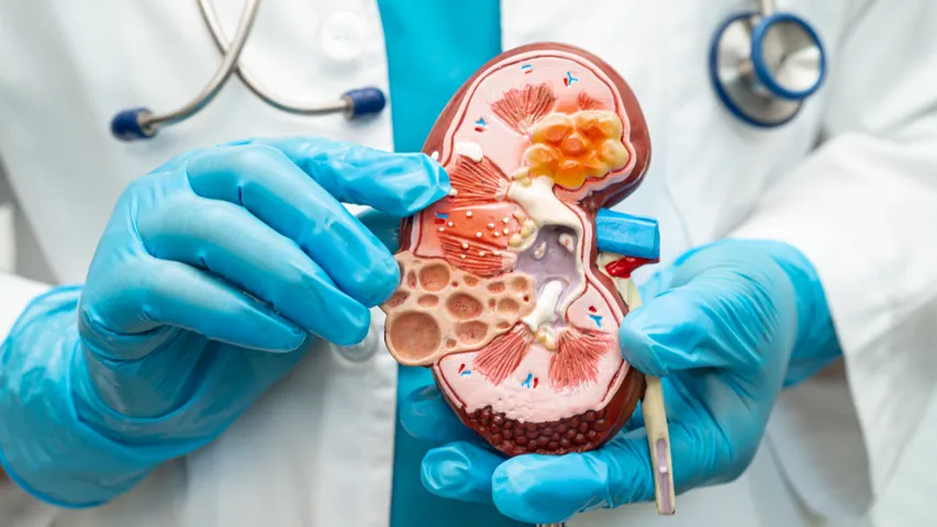 Kidney Disease: ఈ లక్షణాలు కనిపిస్తే కిడ్నీ ఫెయిలైందని అర్థం.. గుర్తుపెట్టుకోండి!