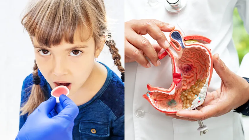 Deworming: కడుపులో పిల్లలకు నులిపురుగులకు మందు తినిపిస్తున్నట్లయితే.. ఈ విషయాల్లో జాగ్రత్తగా ఉండండి!