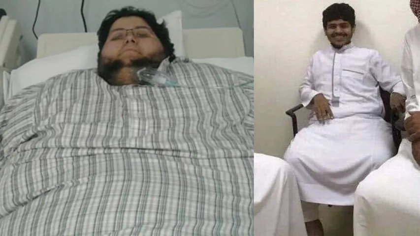 Saudi Arabia: ఒకప్పుడు 610 కేజీలు.. ఇప్పుడు 60 కేజీలకు తగ్గాడు