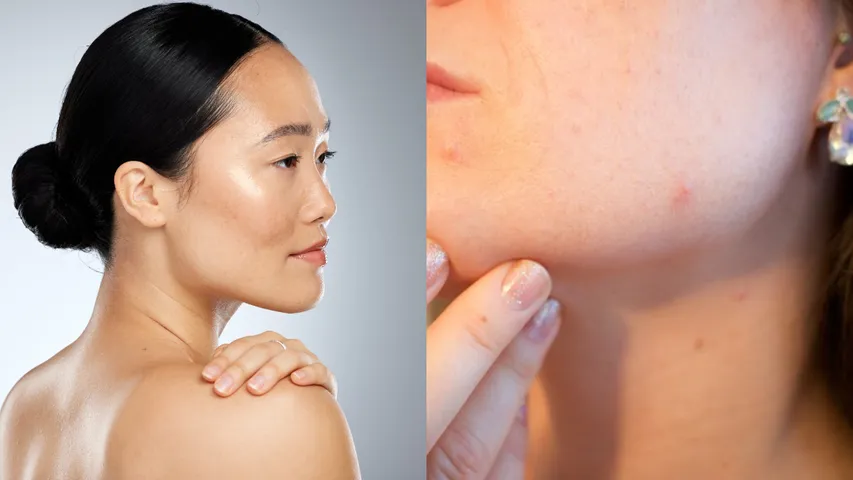 Skin Care