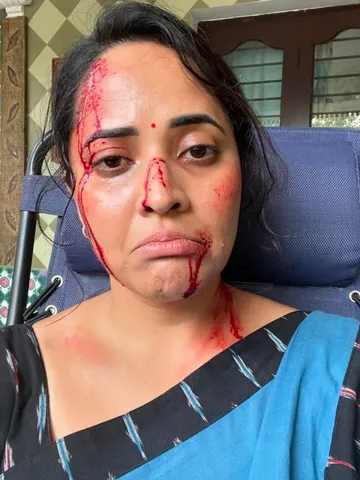 గాయాలతో యాంకర్ అనసూయ పోస్ట్..!