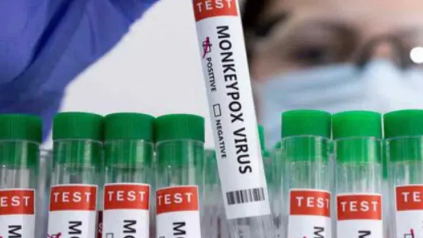 Delhi AIIMS: మంకీపాక్స్ పై అప్రమత్తంగా ఉండాల్సిందే.. ఢిల్లీ ఎయిమ్స్‌ కీలక మార్గదర్శకాలు!